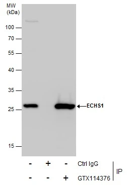 ECHS1 antibody [N1C2] detects ECHS1 protein at mitochondria by immunofluorescent analysis.