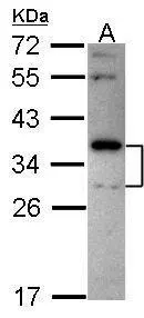 Sample (30 ug of whole cell lysate) A: Hep G2 (GTX27900) 12% SDS PAGE Stomatin antibody GTX114389 diluted at 1:1000 