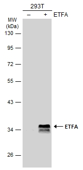 Non-transfected (–) and transfected (+) 293T whole cell extracts (30 μg) were separated by 10% SDS-PAGE, and the membrane was blotted with ETFA antibody (GTX114392) diluted at 1:10000. The HRP-conjugated anti-rabbit IgG antibody (GTX213110-01) was used to detect the primary antibody. Non-transfected (–) and transfected (+) 293T whole cell extracts (30 μg) were separated by 10% SDS-PAGE, and the membrane was blotted with ETFA antibody (GTX114392) diluted at 1:10000. The HRP-conjugated anti-rabbit IgG antibody (GTX213110-01) was used to detect the primary antibody.