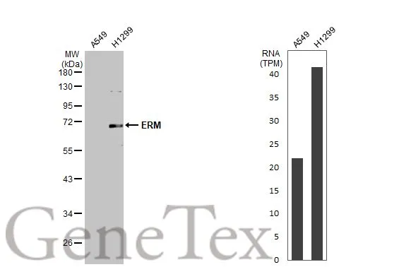 Various whole cell extracts (30 μg) were separated by 10% SDS-PAGE, and the membrane was blotted with ERM antibody (GTX114394) diluted at 1:500. The HRP-conjugated anti-rabbit IgG antibody (GTX213110-01) was used to detect the primary antibody. Corresponding RNA expression data for the same cell lines are based on Human Protein Atlas program.