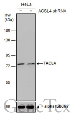 Non-transfected (–) and transfected (+) HeLa whole cell extracts (30 μg) were separated by 7.5% SDS-PAGE, and the membrane was blotted with FACL4 antibody [N1N3] (GTX114399) diluted at 1:1000.