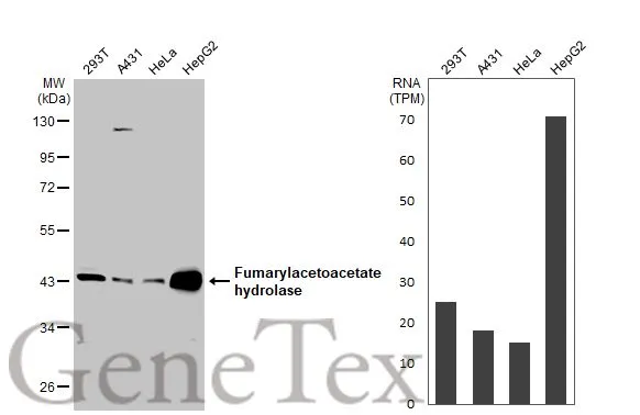 Various whole cell extracts (30 μg) were separated by 10% SDS-PAGE, and the membrane was blotted with FAH antibody (GTX114400) diluted at 1:1000. The HRP-conjugated anti-rabbit IgG antibody (GTX213110-01) was used to detect the primary antibody. Corresponding RNA expression data for the same cell lines are based on Human Protein Atlas program.
