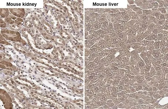 FAH antibody detects FAH protein by immunohistochemical analysis. Sample: Paraffin-embedded mouse tissues. FAH stained by FAH antibody (GTX114400) diluted at 1:500. Antigen Retrieval: Citrate buffer, pH 6.0, 15 min