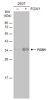 Non-transfected (–) and transfected (+) 293T whole cell extracts (30 μg) were separated by 12% SDS-PAGE, and the membrane was blotted with FOXI1 antibody [N2C3] (GTX114408) diluted at 1:2000. The HRP-conjugated anti-rabbit IgG antibody (GTX213110-01) was used to detect the primary antibody.