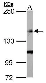 Flightless I antibody [C2C3], C-term detects FLII protein by Western blot analysis. A. 50 μg rat muscle lysate/extract 5 % SDS-PAGE Flightless I antibody [C2C3], C-term (GTX114410) dilution: 1:1000