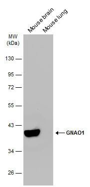 Various tissue extracts (50 μg) were separated by 10% SDS-PAGE, and the membrane was blotted with GNAO1 antibody (GTX114439) diluted at 1:10000. The HRP-conjugated anti-rabbit IgG antibody (GTX213110-01) was used to detect the primary antibody. Various tissue extracts (50 μg) were separated by 10% SDS-PAGE, and the membrane was blotted with GNAO1 antibody (GTX114439) diluted at 1:10000. The HRP-conjugated anti-rabbit IgG antibody (GTX213110-01) was used to detect the primary antibody.