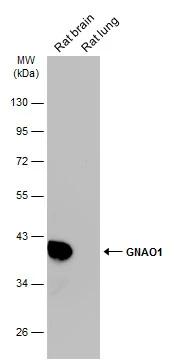 Various tissue extracts (50 μg) were separated by 10% SDS-PAGE, and the membrane was blotted with GNAO1 antibody (GTX114439) diluted at 1:10000. The HRP-conjugated anti-rabbit IgG antibody (GTX213110-01) was used to detect the primary antibody. Various tissue extracts (50 μg) were separated by 10% SDS-PAGE, and the membrane was blotted with GNAO1 antibody (GTX114439) diluted at 1:10000. The HRP-conjugated anti-rabbit IgG antibody (GTX213110-01) was used to detect the primary antibody.