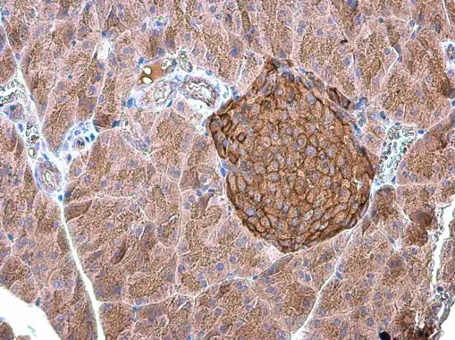 GNAO1 antibody detects GNAO1 protein at cell membrane and cytoplasm in mouse pancreas by immunohistochemical analysis. Sample: Paraffin-embedded mouse pancreas. GNAO1 antibody (GTX114439) diluted at 1:500.
Antigen Retrieval: Citrate buffer, pH 6.0, 15 min GNAO1 antibody detects GNAO1 protein at cell membrane and cytoplasm in mouse pancreas by immunohistochemical analysis. Sample: Paraffin-embedded mouse pancreas. GNAO1 antibody (GTX114439) diluted at 1:500.
Antigen Retrieval: Citrate buffer, pH 6.0, 15 min