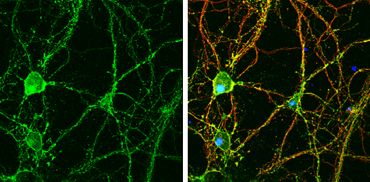 GNAO1 antibody detects GNAO1 protein by immunofluorescent analysis. Sample: DIV9 rat E18 primary hippocampal neuron cells were fixed in 4% paraformaldehyde at RT for 15 min. Green: GNAO1 stained by GNAO1 antibody (GTX114439) diluted at 1:500. Red: beta Tubulin 3/ Tuj1, stained by beta Tubulin 3/ Tuj1 antibody [GT1338] (GTX631831) diluted at 1:500. Blue: Fluoroshield with DAPI (GTX30920).