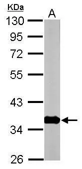 Sample (50 μg of whole cell lysate) A: mouse brain 10% SDS PAGE GTX114442 diluted at 1:10000 The HRP-conjugated anti-rabbit IgG antibody (GTX213110-01) was used to detect the primary antibody.