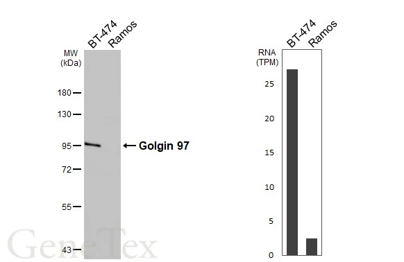 Various whole cell extracts (30 μg) were separated by 7.5% SDS-PAGE, and the membrane was blotted with Golgin 97 antibody [C2C3], C-term (GTX114445) diluted at 1:1000. The HRP-conjugated anti-rabbit IgG antibody (GTX213110-01) was used to detect the primary antibody. Corresponding RNA expression data are based on Human Protein Atlas program.