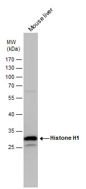 Histone H1 antibody detects Histone H1 protein by western blot analysis. Mouse tissue extracts (50 μg) was separated by 12% SDS-PAGE, and the membrane was blotted with Histone H1 antibody (GTX114462) diluted by 1:5000. The HRP-conjugated anti-rabbit IgG antibody (GTX213110-01) was used to detect the primary antibody.