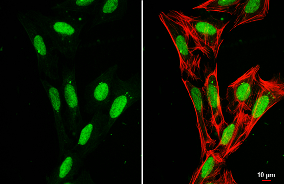 Anti-Histone H1.0 antibody (GTX114462) | GeneTex