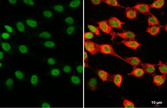 Anti-Histone H1.0 antibody (GTX114462) | GeneTex