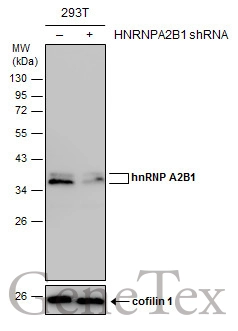 Non-transfected (–) and transfected (+) 293T whole cell extracts (30 μg) were separated by 12% SDS-PAGE, and the membrane was blotted with hnRNP A2B1 antibody (GTX114475) diluted at 1:2000.