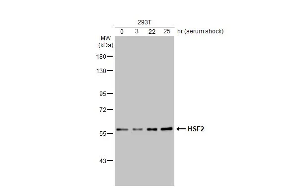 Untreated (–) and treated (+) 293T whole cell extracts (30 μg) were separated by 7.5% SDS-PAGE, and the membrane was blotted with HSF2 antibody [N1N3] (GTX114481) diluted at 1:1000. The HRP-conjugated anti-rabbit IgG antibody (GTX213110-01) was used to detect the primary antibody.