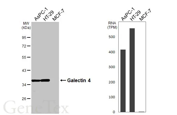 Various whole cell extracts (30 μg) were separated by 10% SDS-PAGE, and the membrane was blotted with Galectin 4 antibody (GTX114527) diluted at 1:1000. The HRP-conjugated anti-rabbit IgG antibody (GTX213110-01) was used to detect the primary antibody. Corresponding RNA expression data for the same cell lines are based on Human Protein Atlas program.