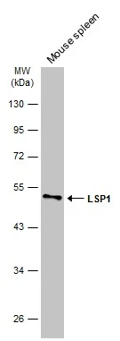 Mouse tissue extract (50 μg) was separated by 10% SDS-PAGE, and the membrane was blotted with LSP1 antibody [N2C3] (GTX114533) diluted at 1:1000. The HRP-conjugated anti-rabbit IgG antibody (GTX213110-01) was used to detect the primary antibody.