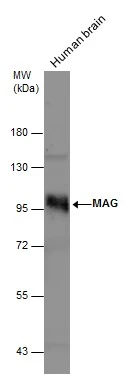 Human tissue extract (30 μg) was separated by 7.5% SDS-PAGE, and the membrane was blotted with MAG antibody (GTX114542) diluted at 1:1000.