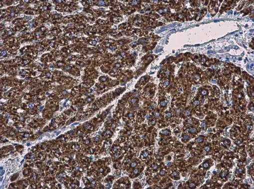 MGST1 antibody [N1C3] detects MGST1 protein at cytoplasm in rat liver by immunohistochemical analysis. Sample: Paraffin-embedded rat liver. MGST1 antibody [N1C3] (GTX114551) diluted at 1:500. 
 Antigen Retrieval: Citrate buffer, pH 6.0, 15 min