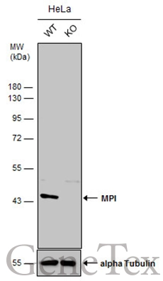 MPI antibody