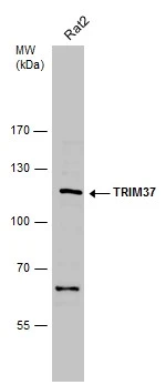 Whole cell extract (30 μg) was separated by 7.5% SDS-PAGE, and the membrane was blotted with TRIM37 antibody [N1N2], N-term (GTX114565) diluted at 1:500. The HRP-conjugated anti-rabbit IgG antibody (GTX213110-01) was used to detect the primary antibody.