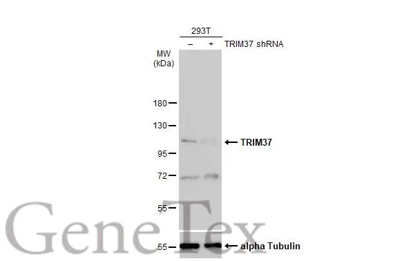 Non-transfected (–) and transfected (+) 293T whole cell extracts (30 μg) were separated by 7.5% SDS-PAGE, and the membrane was blotted with TRIM37 antibody [N1N2], N-term (GTX114565) diluted at 1:1000. The HRP-conjugated anti-rabbit IgG antibody (GTX213110-01) was used to detect the primary antibody, and the signal was developed with Trident ECL plus-Enhanced.