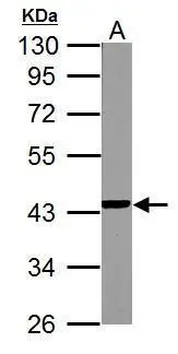 NDUFA10 antibody detects NDUFA10 protein by Western blot analysis. A. 50 μg mouse kidney lysate/extract 10% SDS-PAGE NDUFA10 antibody (GTX114572) dilution: 1:1000
