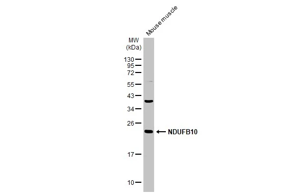 Mouse tissue extract (50 μg) was separated by 12% SDS-PAGE, and the membrane was blotted with NDUFB10 antibody [N1C3] (GTX114576) diluted at 1:1000. The HRP-conjugated anti-rabbit IgG antibody (GTX213110-01) was used to detect the primary antibody, and the signal was developed with Trident ECL plus-Enhanced.
