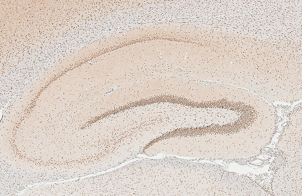 NFIA antibody detects NFIA protein by immunohistochemical analysis. Sample: Paraffin-embedded rat hippocampus. NFIA stained by NFIA antibody (GTX114580) diluted at 1:500. Antigen Retrieval: Citrate buffer, pH 6.0, 15 min