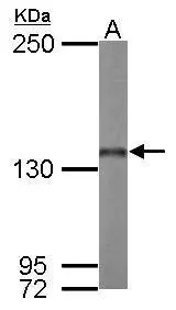 Sample (50 μg of whole cell lysate) A: mouse kidney 5% SDS PAGE GTX114591 diluted at 1:1000 The HRP-conjugated anti-rabbit IgG antibody (GTX213110-01) was used to detect the primary antibody.