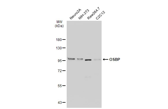 Various whole cell extracts (30 μg) were separated by 7.5% SDS-PAGE, and the membrane was blotted with OSBP antibody [N2C1], Internal (GTX114602) diluted at 1:1000. The HRP-conjugated anti-rabbit IgG antibody (GTX213110-01) was used to detect the primary antibody, and the signal was developed with Trident ECL plus-Enhanced.