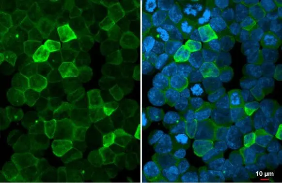 P2Y2 antibody [N3C3] detects P2Y2 protein at cell membrane by immunofluorescent analysis. Sample: K562 cells were fixed in 4% paraformaldehyde at RT for 15 min. Green: P2Y2 stained by P2Y2 antibody [N3C3] (GTX114609) diluted at 1:500. Blue: Hoechst 33342 staining.