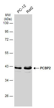 Various whole cell extracts (30 μg) were separated by 10% SDS-PAGE, and the membrane was blotted with PCBP2 antibody [N1C1] (GTX114616) diluted at 1:1000. The HRP-conjugated anti-rabbit IgG antibody (GTX213110-01) was used to detect the primary antibody, and the signal was developed with Trident ECL plus-Enhanced.