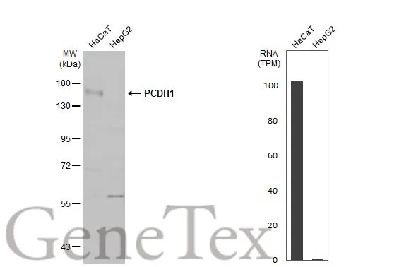 Various whole cell extracts (30 μg) were separated by 7.5% SDS-PAGE, and the membrane was blotted with PCDH1 antibody [C2C3], C-term (GTX114620) diluted at 1:1000. The HRP-conjugated anti-rabbit IgG antibody (GTX213110-01) was used to detect the primary antibody. Corresponding RNA expression data for the same cell lines are based on Human Protein Atlas program.