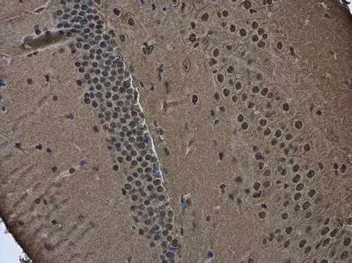 Anti-Brn2 antibody (GTX114650) | GeneTex