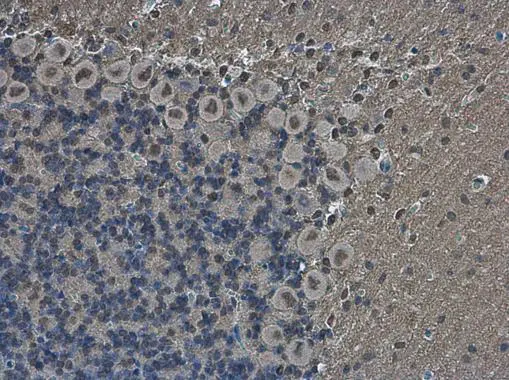 Anti-Brn2 antibody (GTX114650) | GeneTex