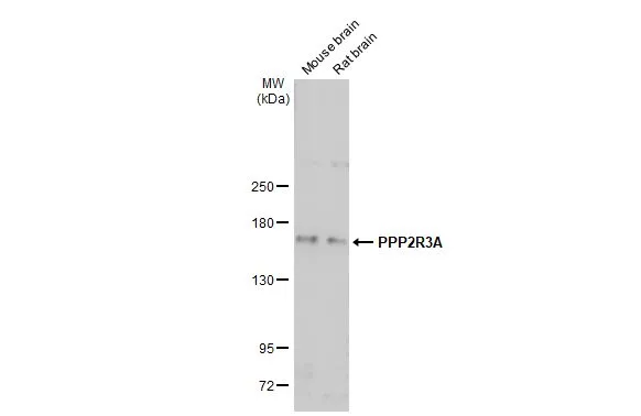 Various tissue extracts (50 μg) were separated by 5% SDS-PAGE, and the membrane was blotted with PPP2R3A antibody [C2C3], C-term (GTX114655) diluted at 1:1000. The HRP-conjugated anti-rabbit IgG antibody (GTX213110-01) was used to detect the primary antibody, and the signal was developed with Trident ECL plus-Enhanced.