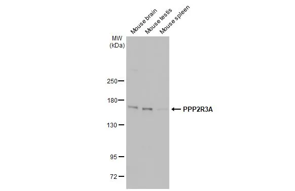 Various tissue extracts (50 μg) were separated by 5% SDS-PAGE, and the membrane was blotted with PPP2R3A antibody [C2C3], C-term (GTX114655) diluted at 1:500. The HRP-conjugated anti-rabbit IgG antibody (GTX213110-01) was used to detect the primary antibody.