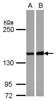 Sample (30 ug of whole cell lysate) A: NT2D1 B: U87-MG 5% SDS PAGE GTX114655 diluted at 1:1000 The HRP-conjugated anti-rabbit IgG antibody (GTX213110-01) was used to detect the primary antibody.