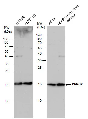 PRRG2 antibody detects PRRG2 protein by western blot analysis. Various whole cell extracts (30 μg) and A549 membrane extracts (30 μg) were separated by 15% SDS-PAGE, and the membrane was blotted with PRRG2 antibody (GTX114668) diluted by 1:1000.