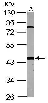 PSMC6 antibody