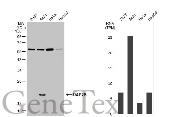 Various whole cell extracts (30 μg) were separated by 12% SDS-PAGE, and the membrane was blotted with RAP2B antibody (GTX114702) diluted at 1:1000. The HRP-conjugated anti-rabbit IgG antibody (GTX213110-01) was used to detect the primary antibody. Corresponding RNA expression data for the same cell lines are based on Human Protein Atlas program. Various whole cell extracts (30 μg) were separated by 12% SDS-PAGE, and the membrane was blotted with RAP2B antibody (GTX114702) diluted at 1:1000. The HRP-conjugated anti-rabbit IgG antibody (GTX213110-01) was used to detect the primary antibody. Corresponding RNA expression data for the same cell lines are based on Human Protein Atlas program.