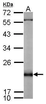 Sample (50 ug of whole cell lysate) A: mouse brain 12% SDS PAGE GTX114702 diluted at 1:1000 Sample (50 ug of whole cell lysate) A: mouse brain 12% SDS PAGE GTX114702 diluted at 1:1000
