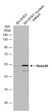 SH-SY5Y whole cell and nuclear extracts (30 μg) were separated by 10% SDS-PAGE, and the membrane was blotted with RbAp48 antibody [C1C3] (GTX114707) diluted at 1:500. The HRP-conjugated anti-rabbit IgG antibody (GTX213110-01) was used to detect the primary antibody.