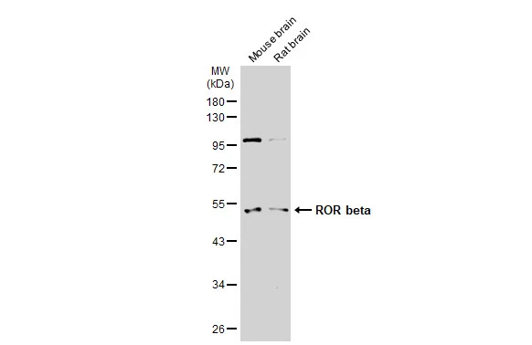 Various tissue extracts (50 μg) were separated by 10% SDS-PAGE, and the membrane was blotted with ROR beta antibody (GTX114722) diluted at 1:500. The HRP-conjugated anti-rabbit IgG antibody (GTX213110-01) was used to detect the primary antibody.