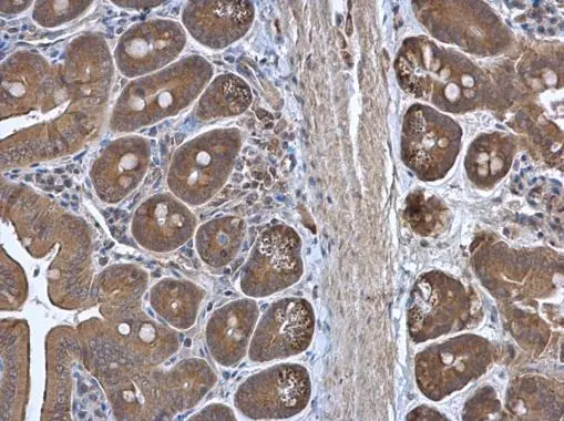 RPL3 antibody [N3C3] detects RPL3 protein at cytoplasm in mouse intestine by immunohistochemical analysis. Sample: Paraffin-embedded mouse intestine. RPL3 antibody [N3C3] (GTX114725) diluted at 1:500. 
 Antigen Retrieval: Citrate buffer, pH 6.0, 15 min