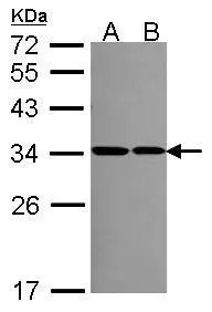 Sample (30 ug of whole cell lysate) A: 293T B: A431 (GTX27909) 12% SDS PAGE GTX114734 diluted at 1:1000 