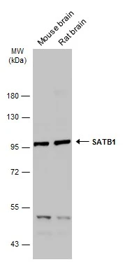 Various tissue extracts (50 μg) were separated by 7.5% SDS-PAGE, and the membrane was blotted with SATB1 antibody (GTX114737) diluted at 1:500. The HRP-conjugated anti-rabbit IgG antibody (GTX213110-01) was used to detect the primary antibody.