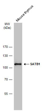 Mouse tissue extract (50 μg) was separated by 7.5% SDS-PAGE, and the membrane was blotted with SATB1 antibody (GTX114737) diluted at 1:5000. The HRP-conjugated anti-rabbit IgG antibody (GTX213110-01) was used to detect the primary antibody.